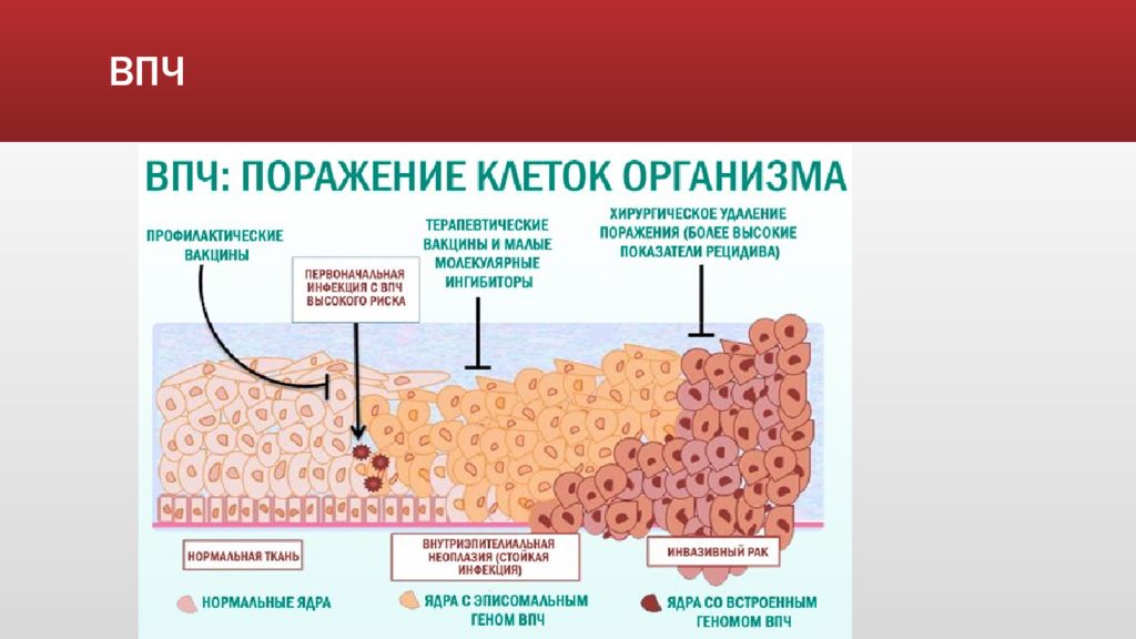 Схема лечения папиллом