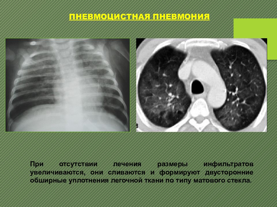 Уплотнение по типу матового