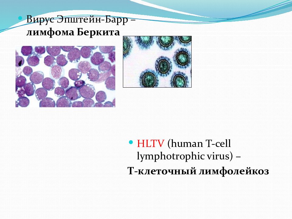 Вирус Эпштейна-Барр и лимфома. Вирус т клеточной лимфомы. Т клеточная лимфома человека. Вирус т клеточной лимфомы 3.