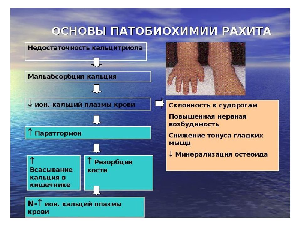 Водно электролитный обмен презентация