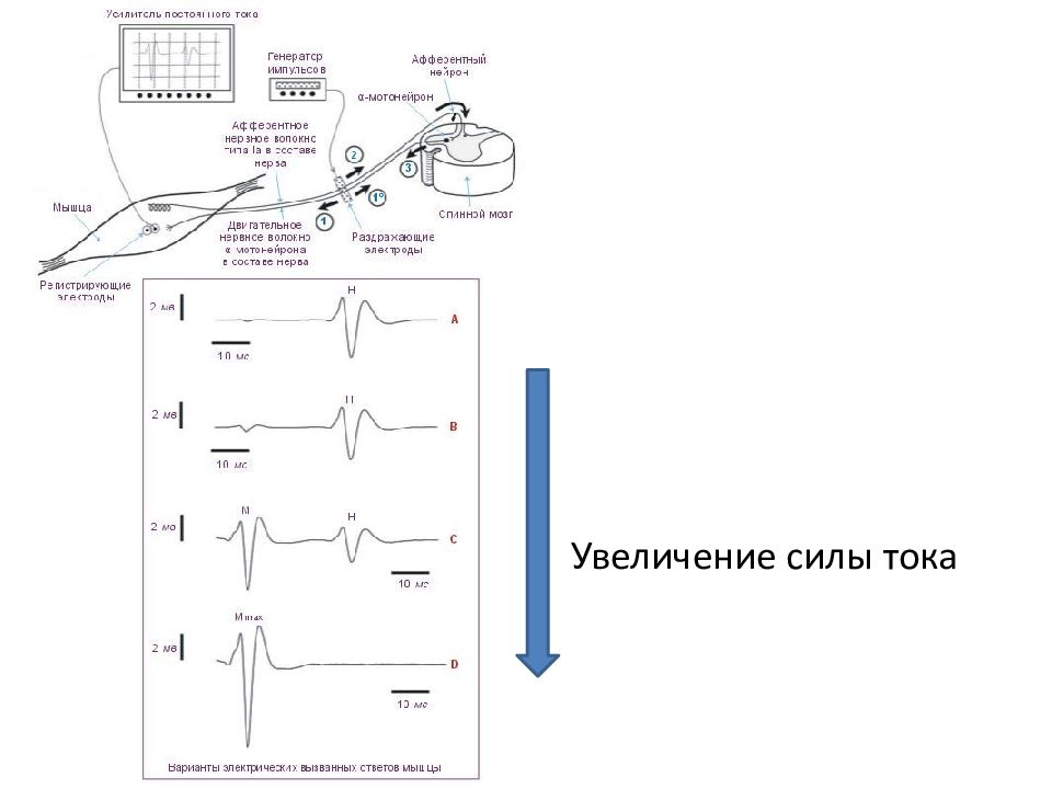 Функциональная диагностика мышц. Вызванные электрические ответы мышцы и нерва. Электроды для раздражения нерва регистрации потенциалов.