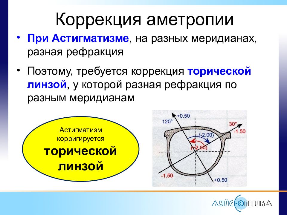 Коррекция астигматизма. Астигматизм меридианы. Способы коррекции аметропий. Методика контактной коррекции аметропии. Главные оптические меридианы астигматического глаза.