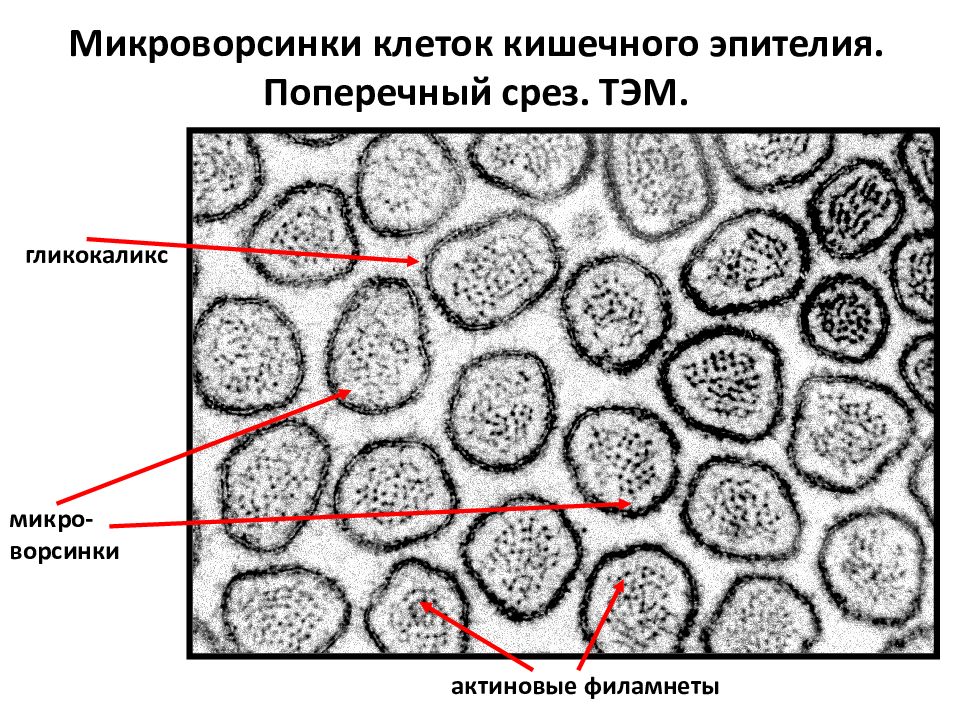 Клетки эпителия кишечника рисунок