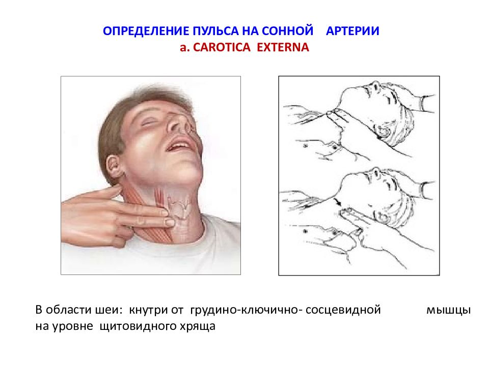 Где у человека находится сонная артерия покажи на картинке