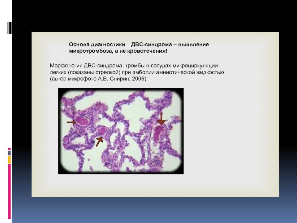 Патологическая анатомия васкулитов презентация