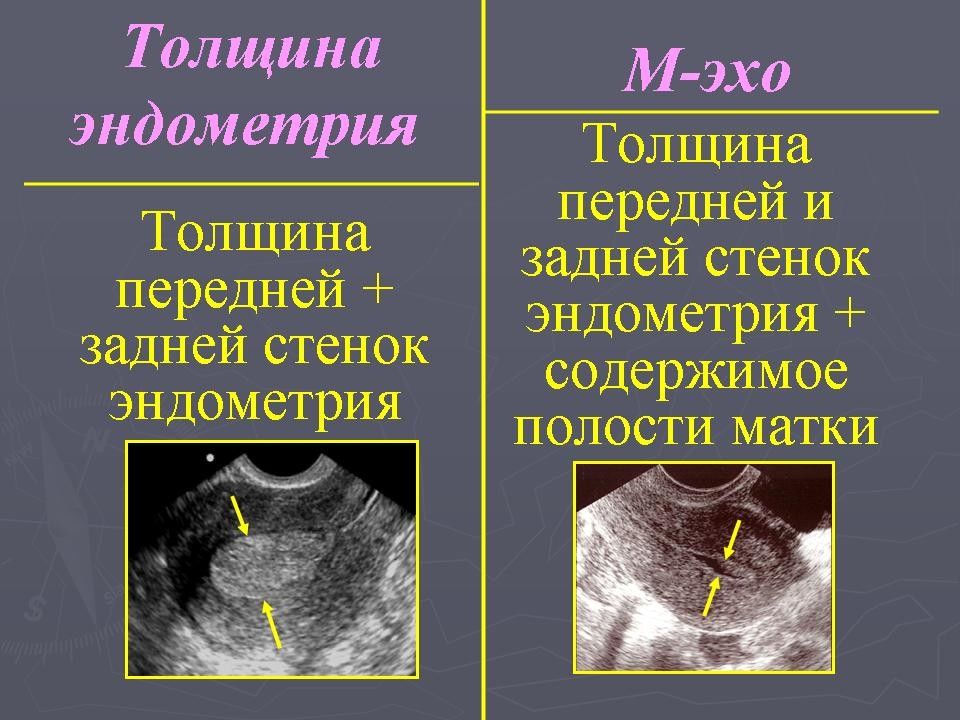 Лучевая диагностика в гинекологии презентация