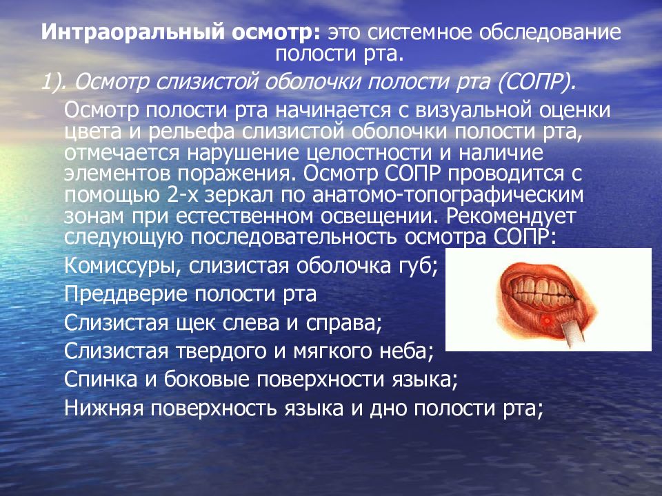 Осмотр полостей. Интраоральный осмотр: это системное обследование полости рта.. Обследование слизистой оболочки полости рта. Осмотр слизистой полости рта.