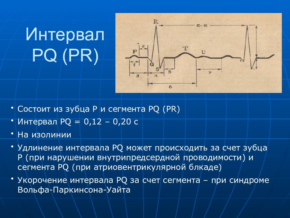 Основы экг презентация