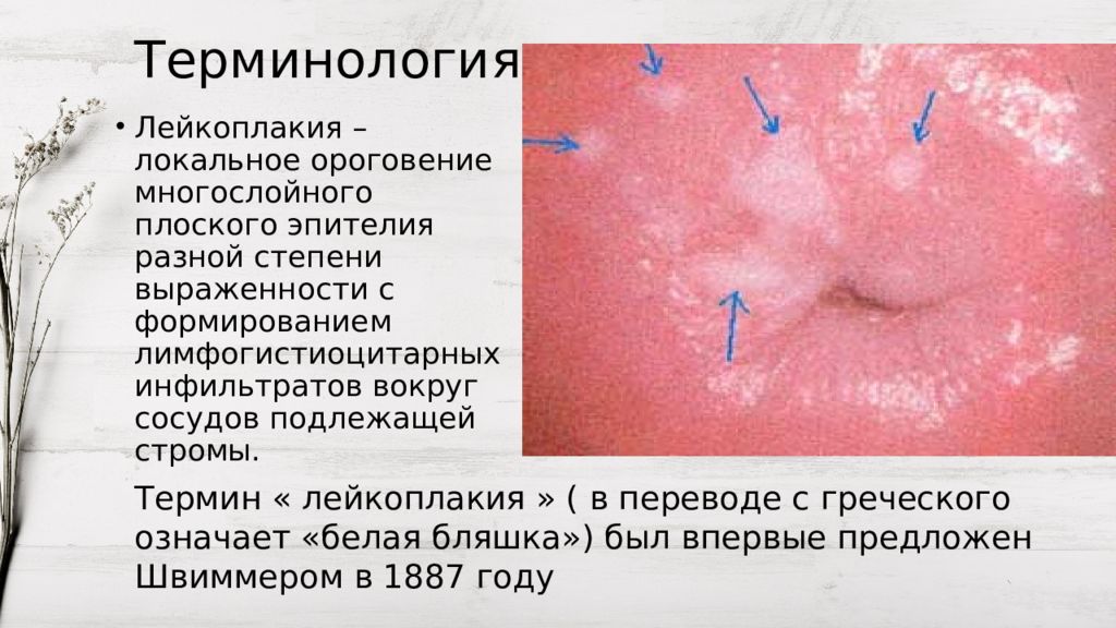 Рак шейки матки презентация гинекология