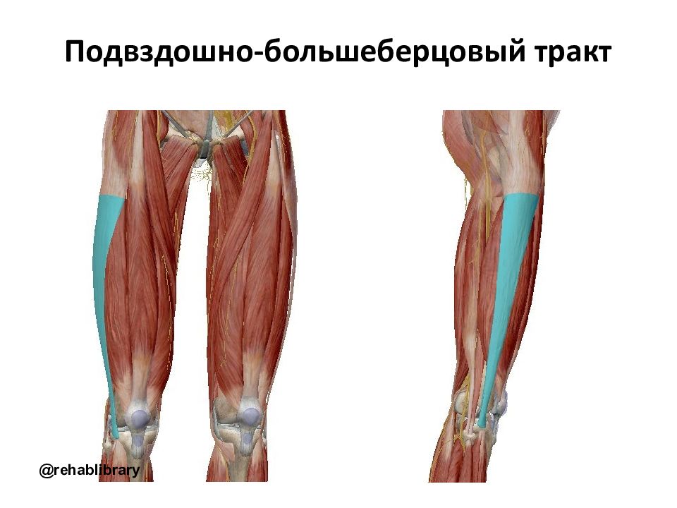 Подвздошно большеберцовый тракт. Синдром илиотибиального тракта. Синдром подвздошно-большеберцового тракта. Подвздошно-большеберцовый тракт (Tractus iliotibialis). Илиотибиальный тракт бедра.
