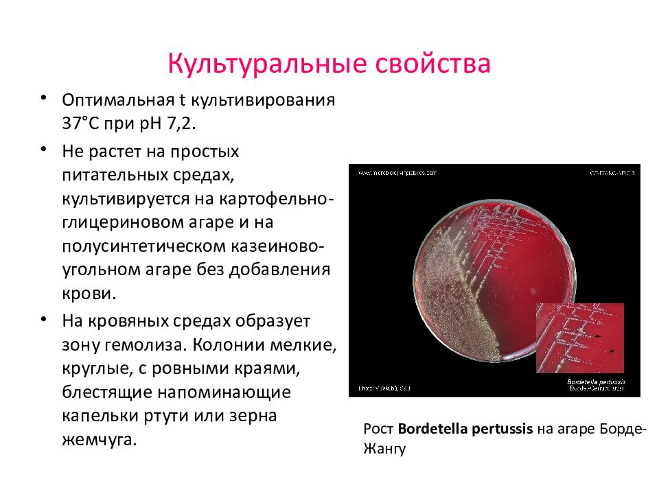 Возбудитель коклюша. Коклюш характеристика возбудителя. Столбняк на питательной среде. Культуральные свойства дифтерии. Коклюш микробиология презентация.