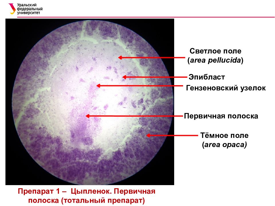 Первичный узелок. Первичная полоска гаструляция препарат. Первичная полоска гистология препарат. Образование первичной полоски и гензеновского узелка.