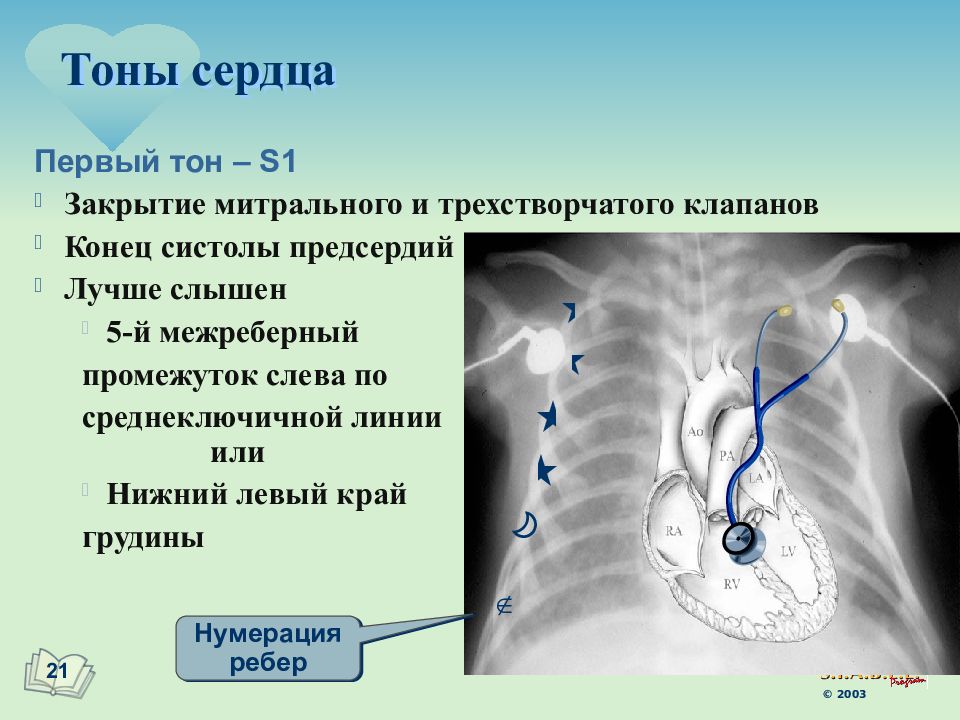 1 тон сердца. Тоны сердца. II тон сердца возникает. Понятие о тонах сердца.