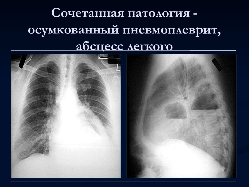 Лучевая диагностика органов дыхания презентация