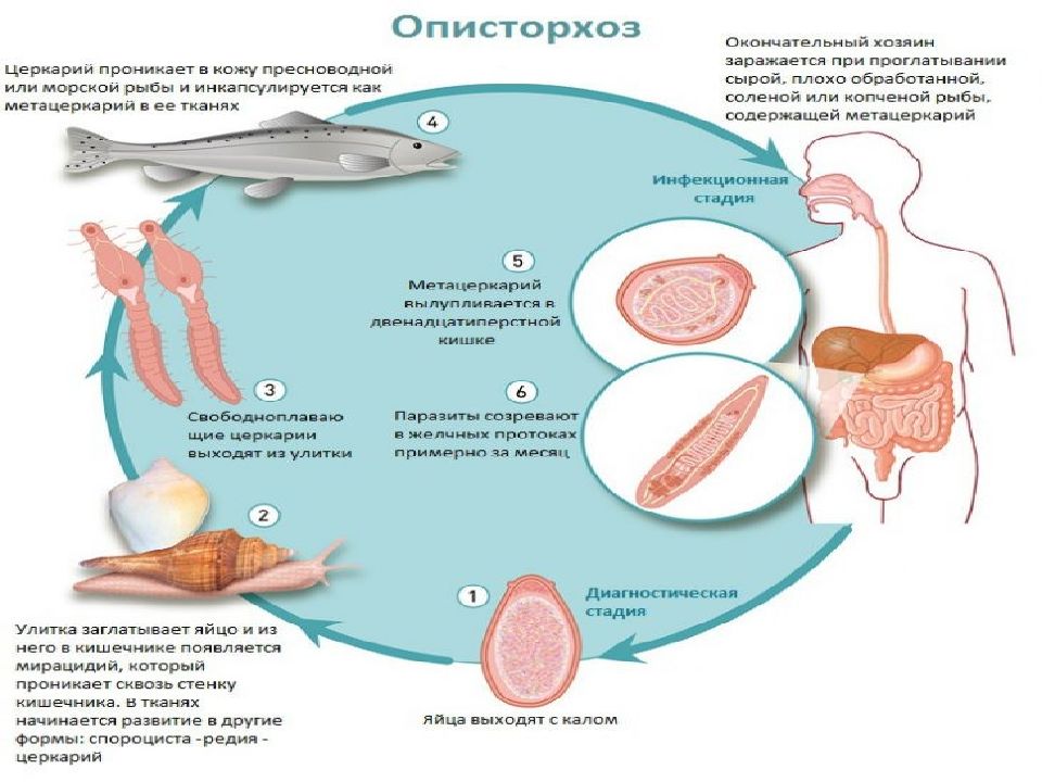 Презентация на тему описторхоз