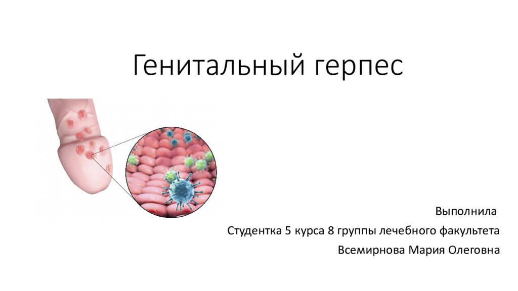 Генитальный герпес