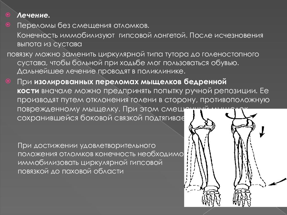 Этапы лечения переломов. Открытый перелом диафиза бедренной кости. Бедренная кость перелом диафиза. Перелом диафиза бедренной кости. Перелом диафиза бедренной кости смещение отломков.