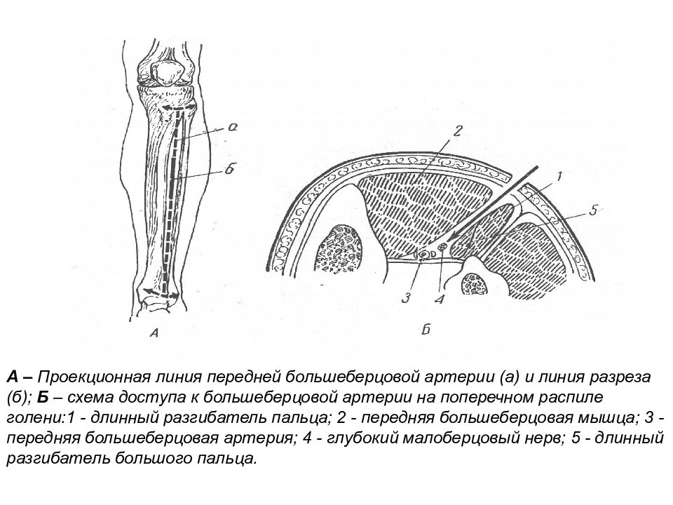 Проекционная линия бедренной артерии. Срез бедра топографическая анатомия. Поперечный срез предплечья в верхней трети. Проекционная линия передней большеберцовой. Проекционная линия передней большеберцовой артерии.