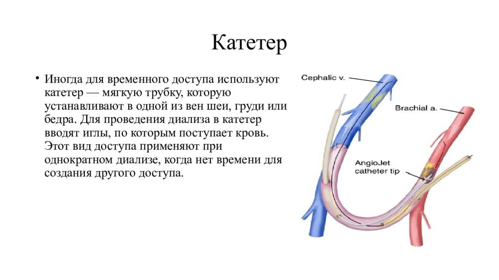 Перитонеальный диализ презентация