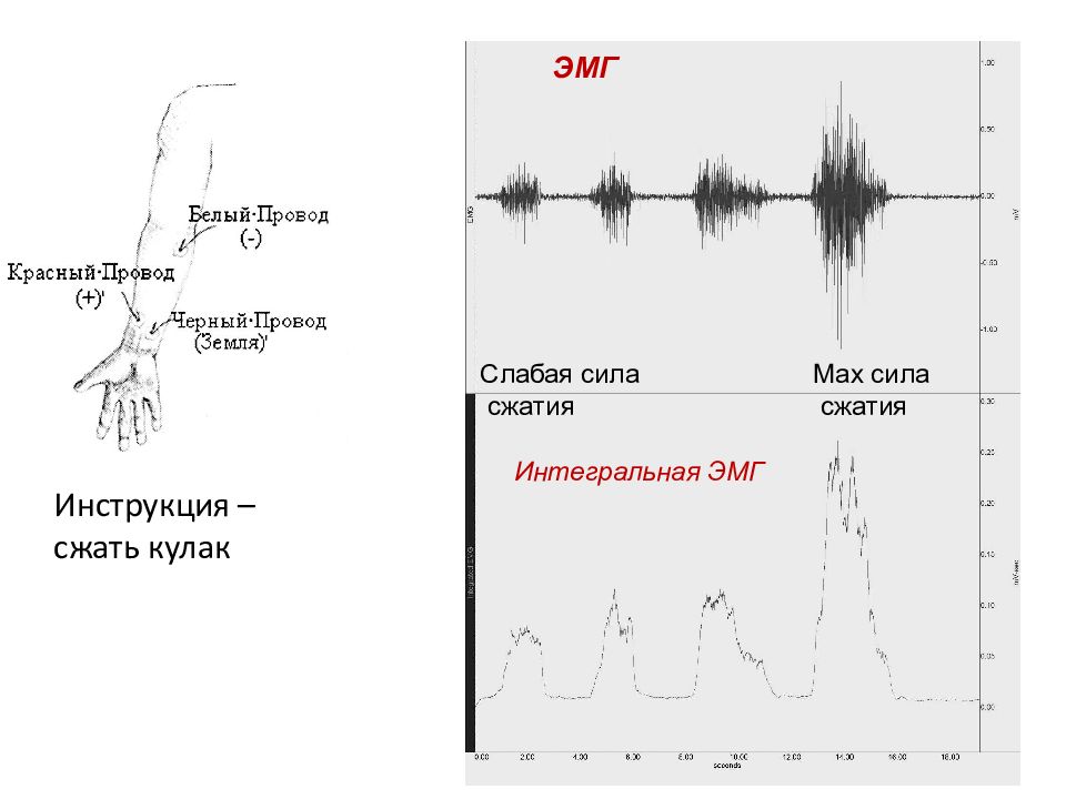 Эмг самара. Электромиография (ЭМГ). Электромиография график. ЭМГ мышц. ЭМГ сигнал.