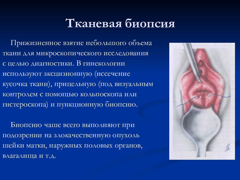 Методы обследования в акушерстве презентация