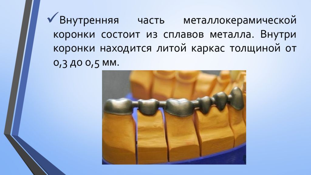 Металлокерамические мостовидные протезы презентация