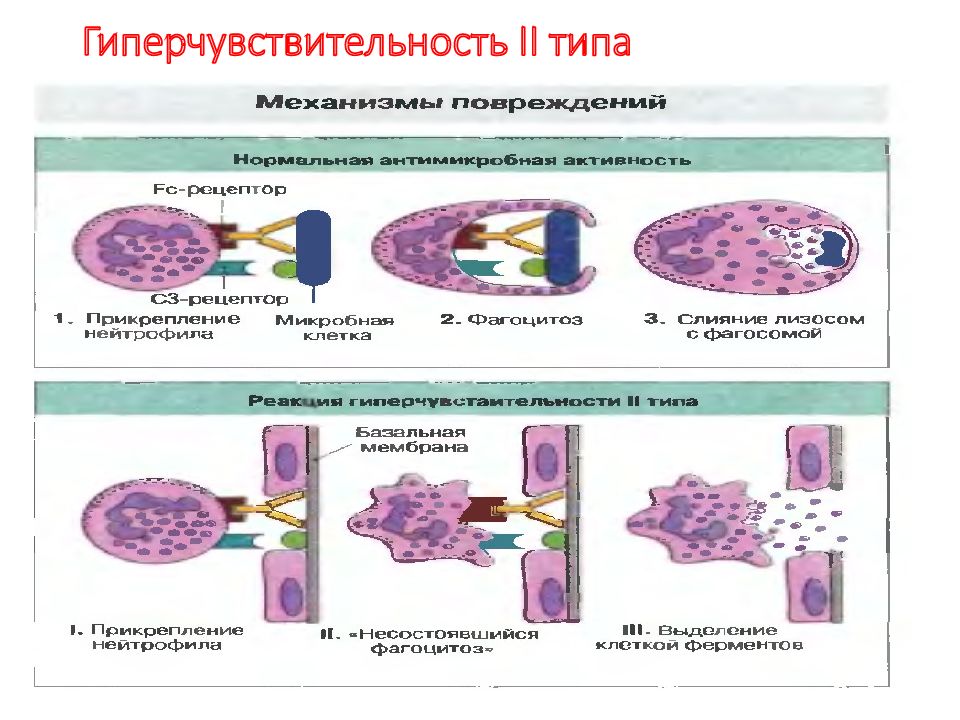 Второй тип аллергической реакции схема