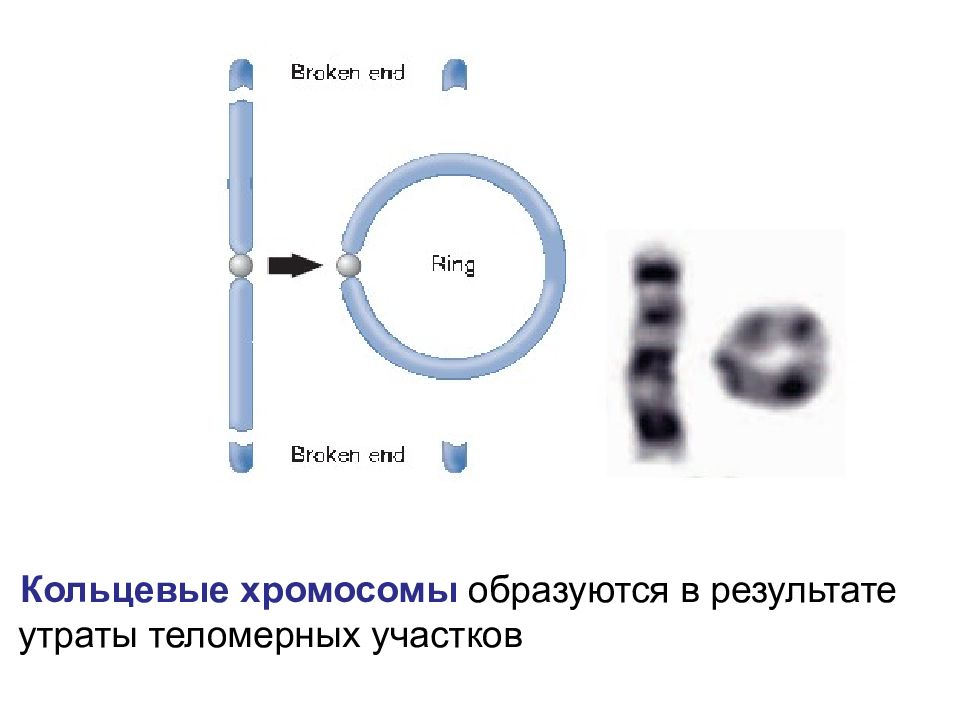 Кольцевая 4 хромосома. Кольцевая хромосома. Возникновение кольцевых хромосом. Образование кольцевой хромосомы. Механизм образования кольцевой хромосомы.