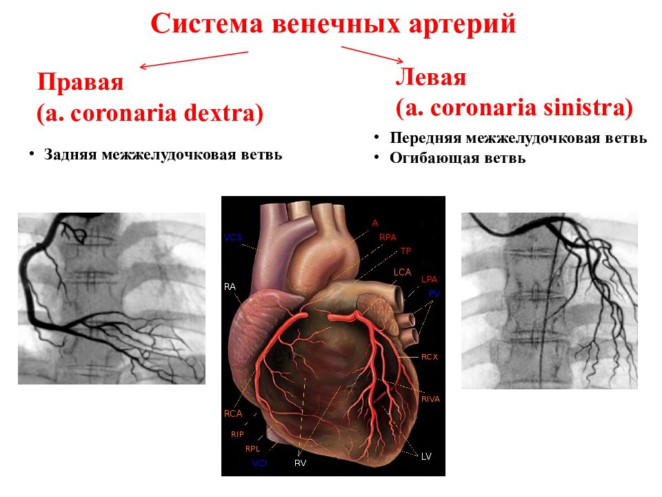 Правая сердечная артерия. Коронарные венечные сосуды. Коронарография схема сосудов. Огибающая правой венечной артерии. Коронарные и венечные артерии сердца.