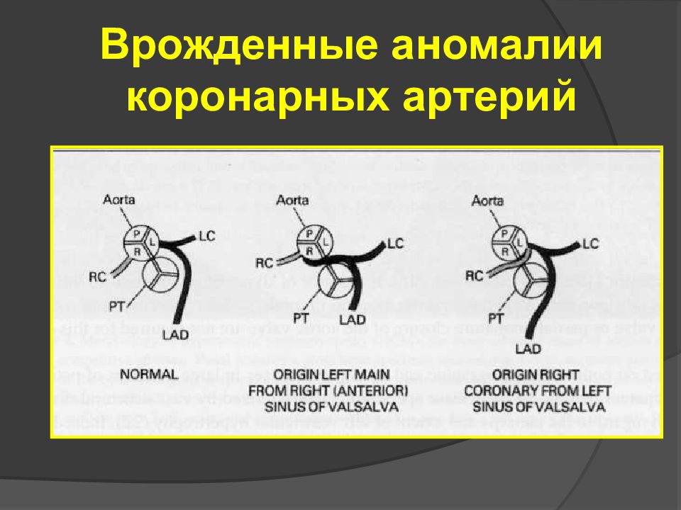 Спортивное сердце презентация