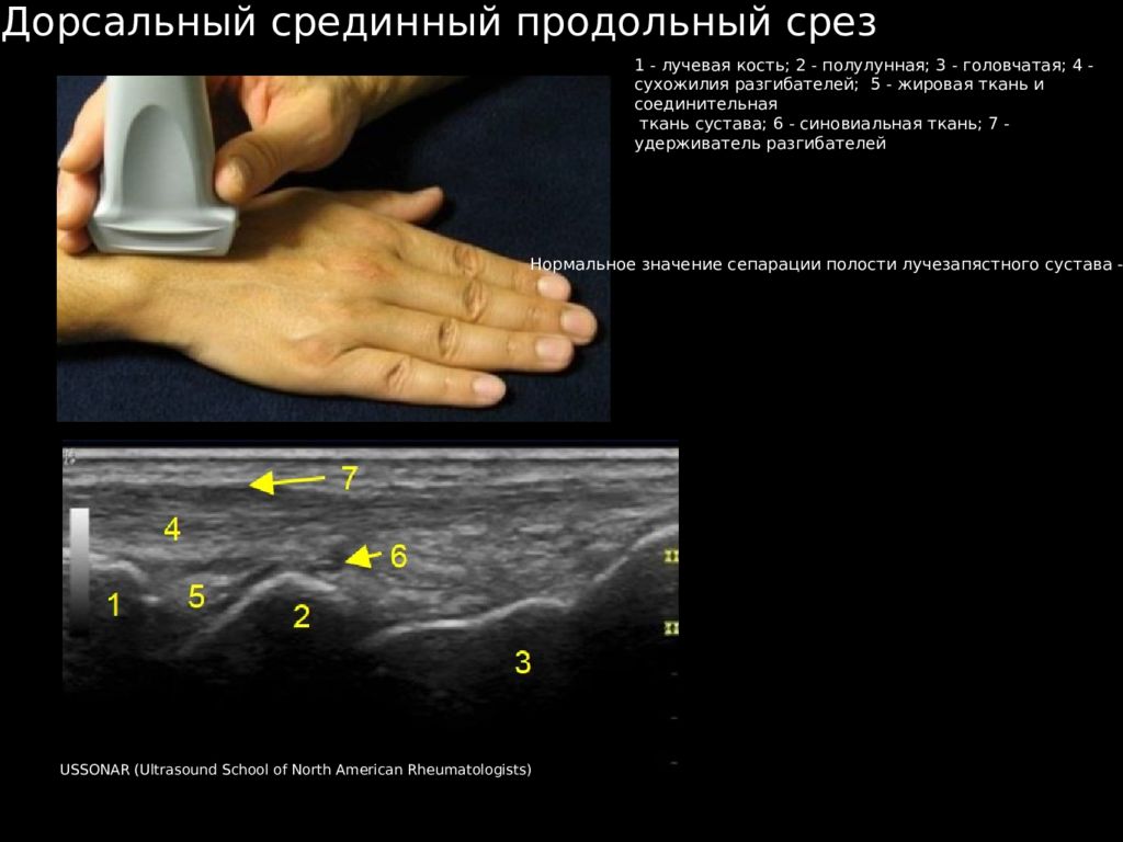 Ультразвуковое исследование презентация