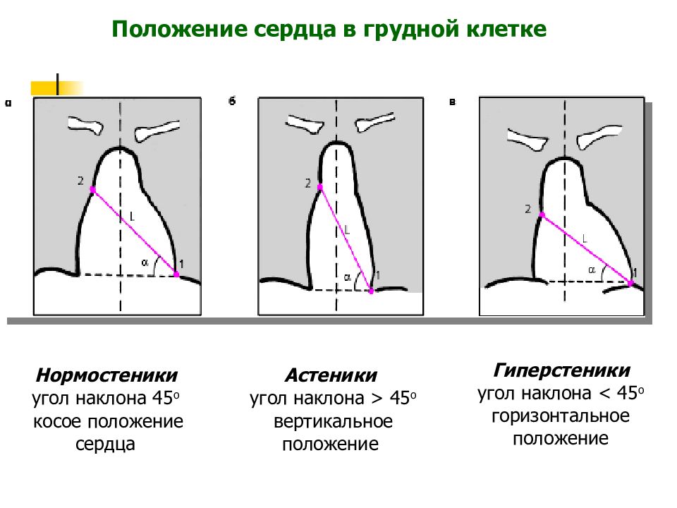 Положения грудной клетки. Положение сердца у гиперстеников. Вертикальное положение сердца. Положение сердца в грудной клетке. Положение сердца в грудной клет.