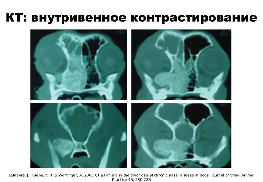 Кт с внутривенным контрастированием. Кт грудной полости с внутривенным болюсным контрастированием. Кт с внутривенным контрастированием. Кт болюсное контрастирование. Кт болюсное контрастирование.