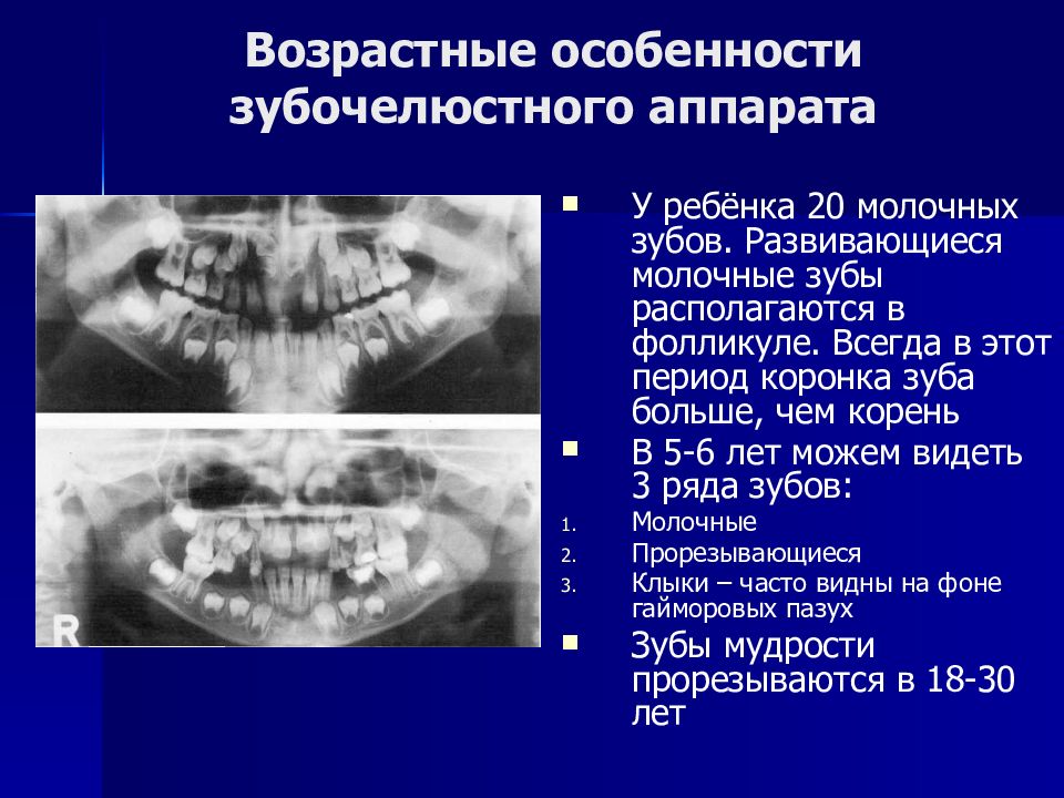 Оперативное лечение при аномалиях и деформациях верхней челюсти презентация