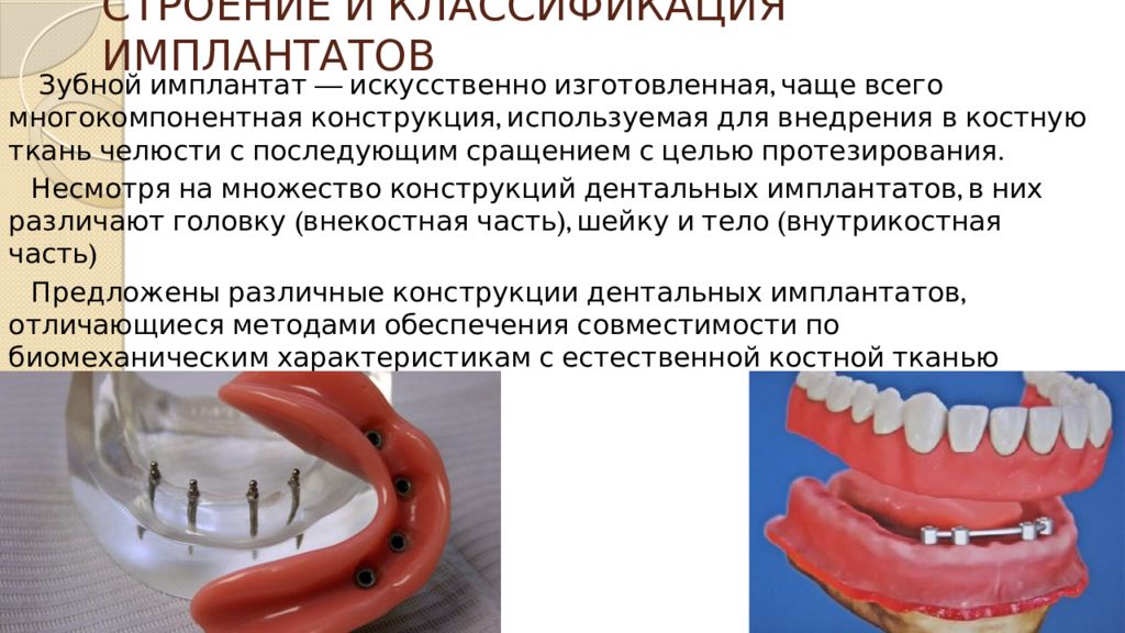 Анатомические предпосылки стоматологической имплантации презентация