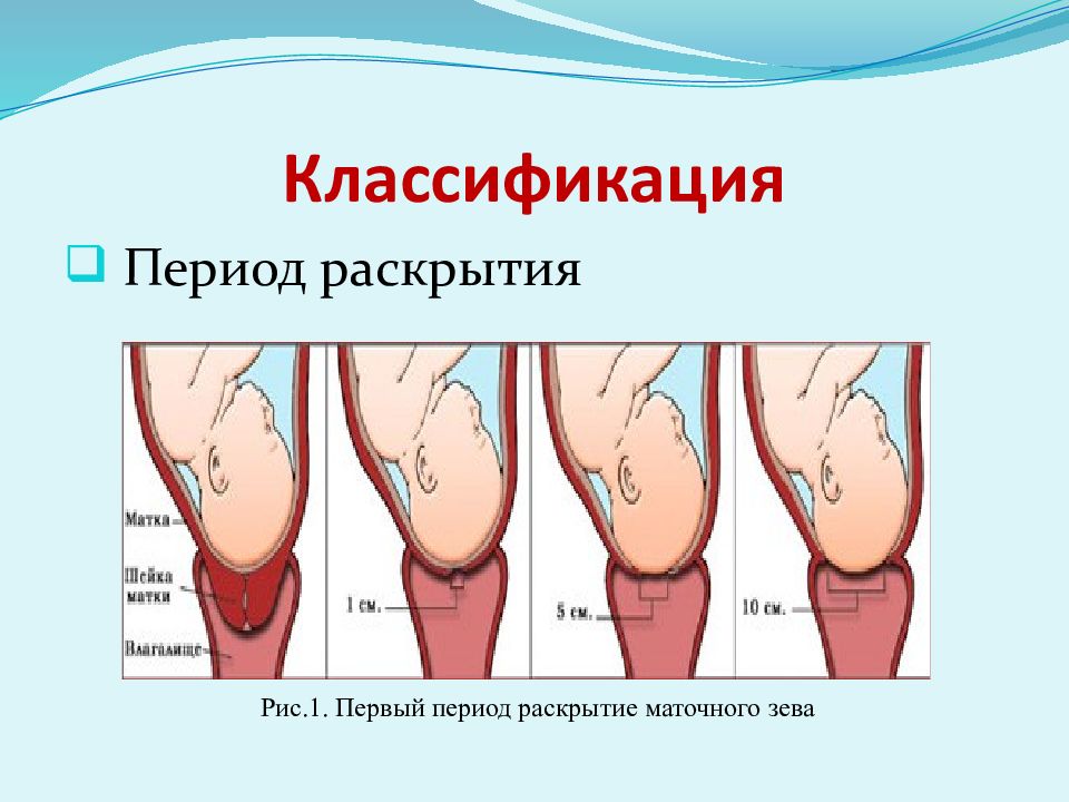 Почему раскрывается матка. Раскрытие маточного зева. Период раскрытия шейки матки. Раскрытие маточного зева при родах.