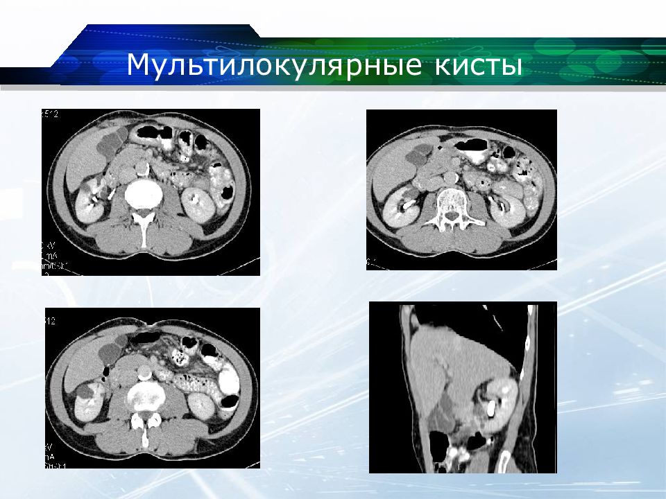 Кт почек презентация