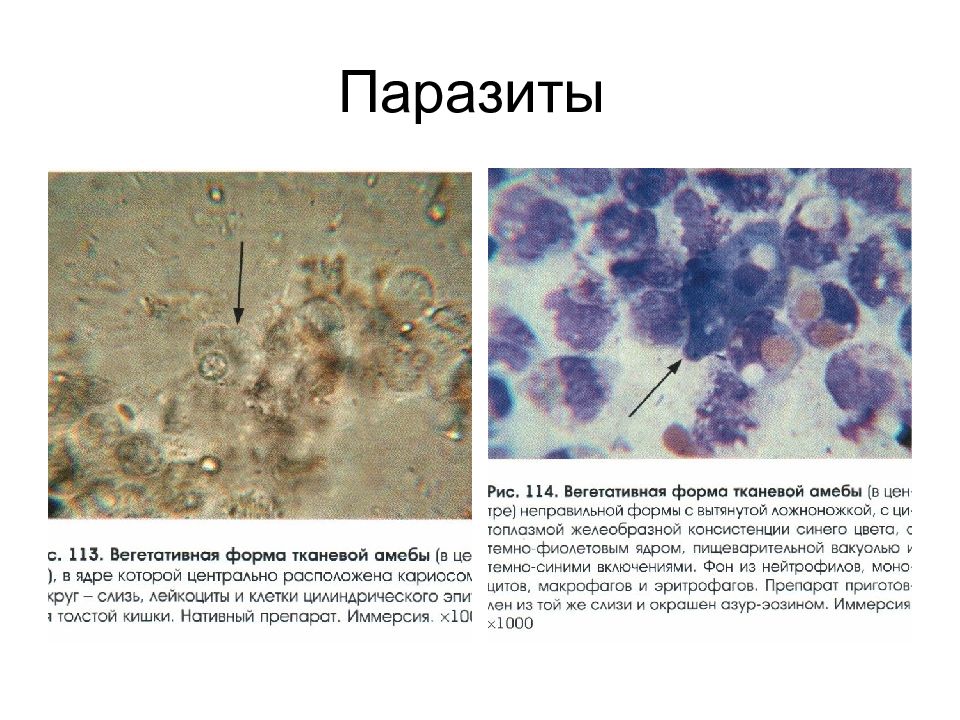 Исследование микроскопической картины кала