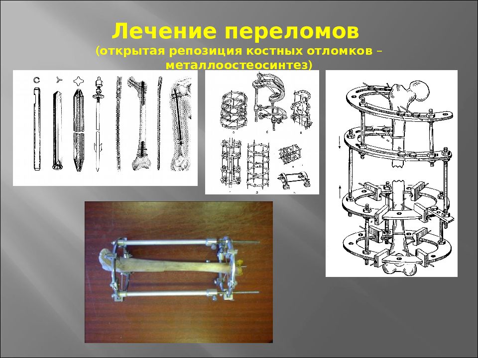 Основы травматологии презентация