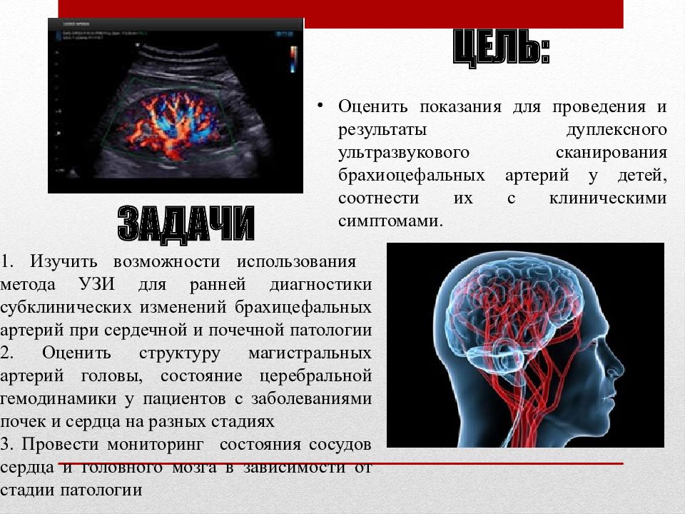 Брахиоцефальные артерии схема