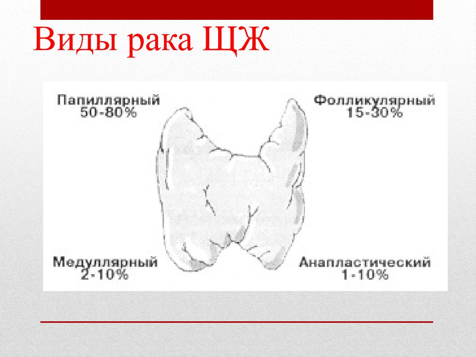 Презентация на тему рак щитовидной железы