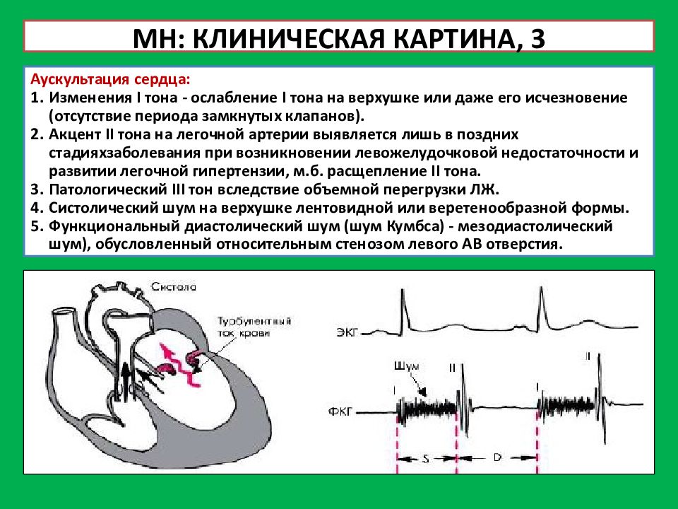 Аускультативная картина при открытом артериальном протоке характеризуется наличием