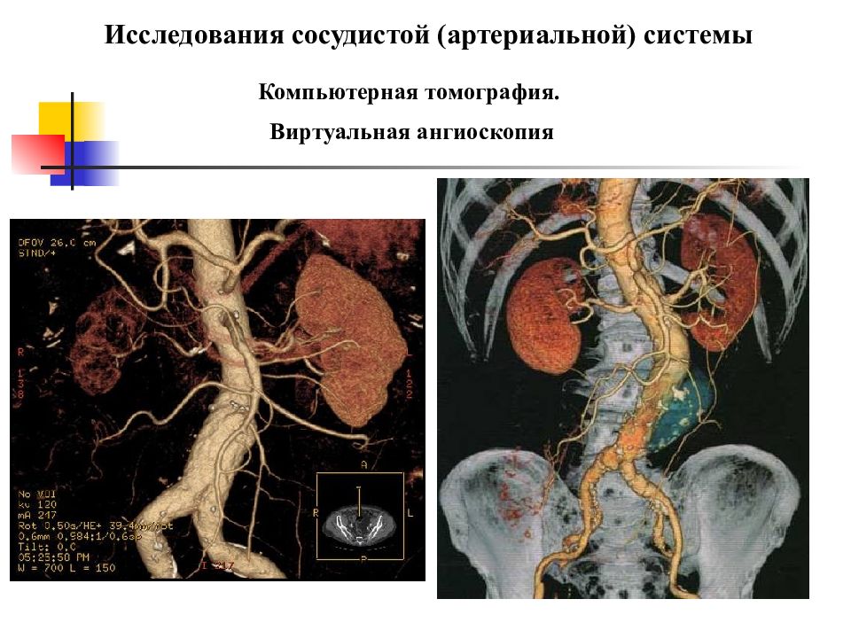 Сосудистые исследования. Исследование кровообращения. Компьютерная томография на сосудистой системы. Развитие артериальной системы. Кт в исследовании органов сердечно - сосудистой системы.