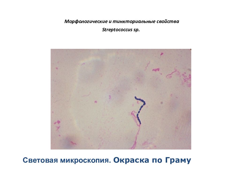 Стрептококус спп. Световая микроскопия окраска по Граму. Морфологические и тинкториальные свойства пневмококков. Стрептококки тинкториальные свойства. Streptococcus pneumoniae тинкториальные свойства.