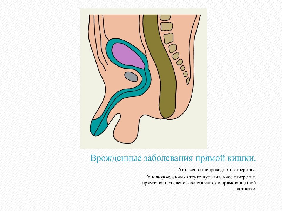 Травмы и заболевания прямой кишки презентация