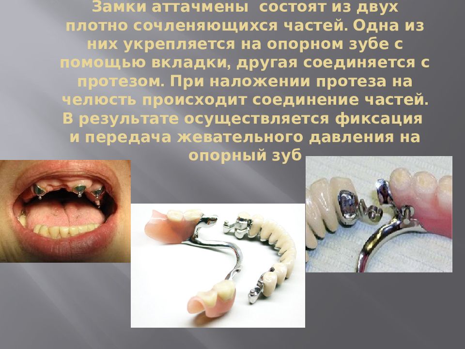 Тема: Частично съемный пластиночный протез — презентация