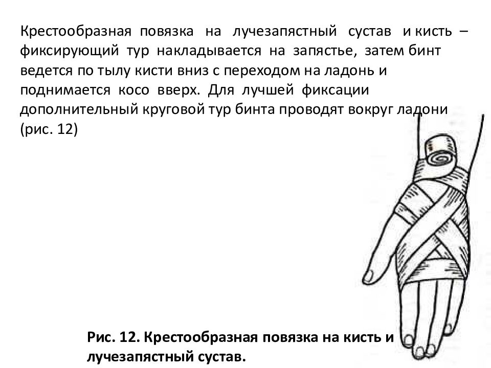 Крестообразная повязка. Крестообразная (восьмиобразная) повязка на кисть. Восьмиобразная повязка на лучезапястный сустав. Повязка на лучезапястный сустав алгоритм. Наложение повязки на лучезапястный сустав алгоритм.