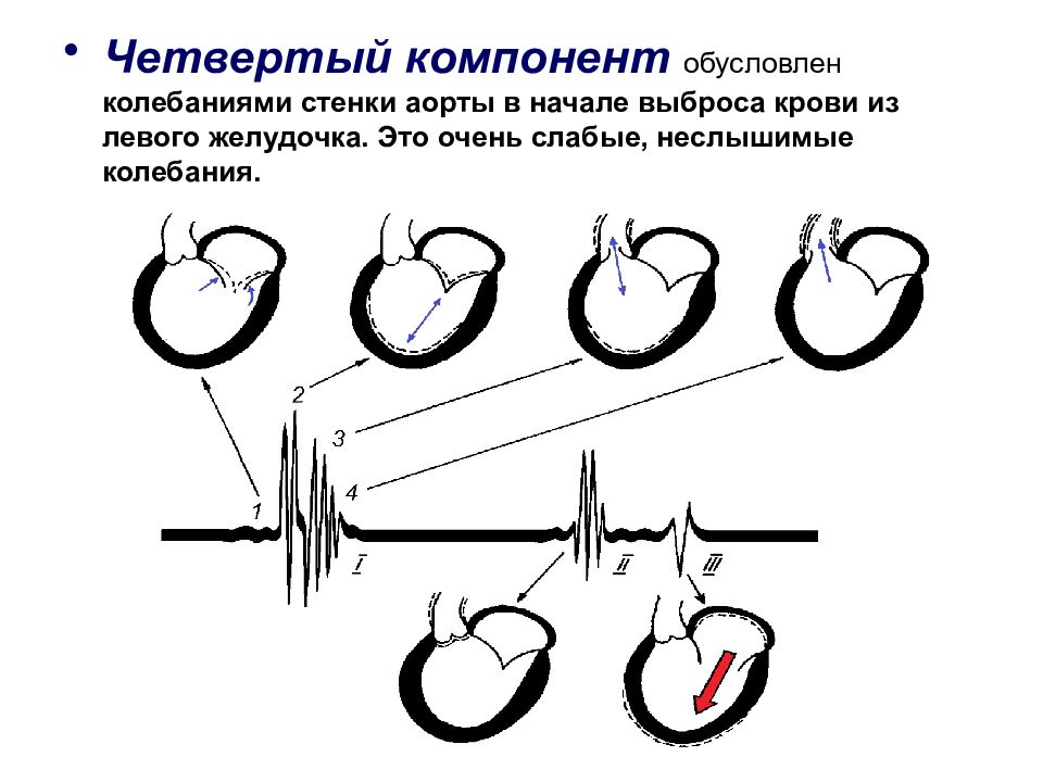 Обусловленная колебаниями. Аускультация левого желудочка. Колебания стенки аорты. Аускультация при аневризме левого желудочка. Аускультация сердца при гипертрофии левого желудочка.