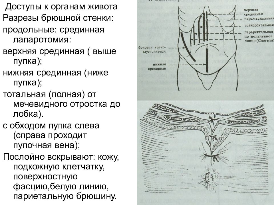 Кишечные швы топографическая анатомия презентация