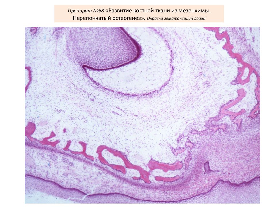 Ткань препарат. Прямой остеогенез препарат гистология. Прямой остеогистогенез препарат гистология. Прямой остеогенез из мезенхимы препарат гистология. Развитие кости из мезенхимы прямой остеогенез.